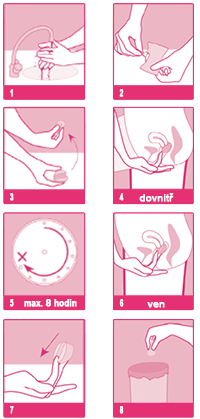 zavádění a vyndávání tampónu Beppy